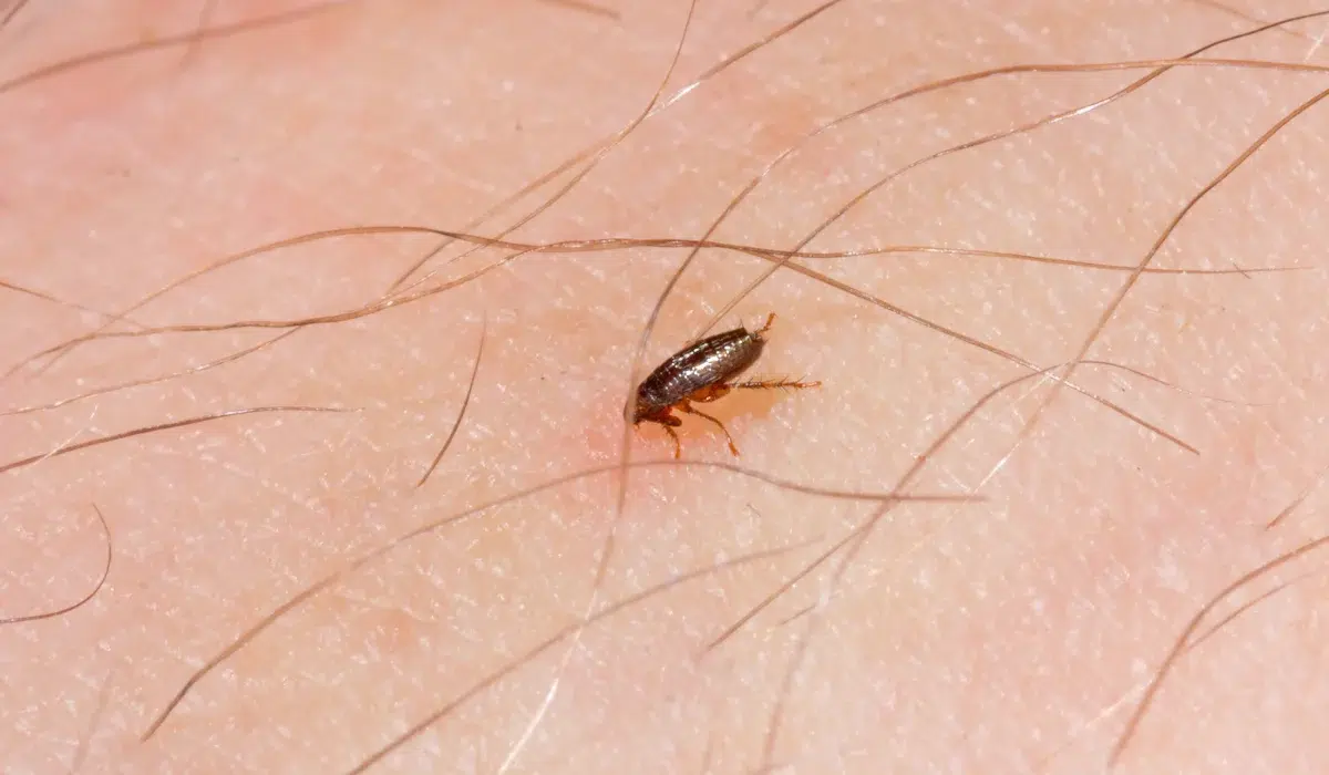 A Little Flea Bites On A Human